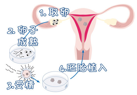 单身同志供卵公司